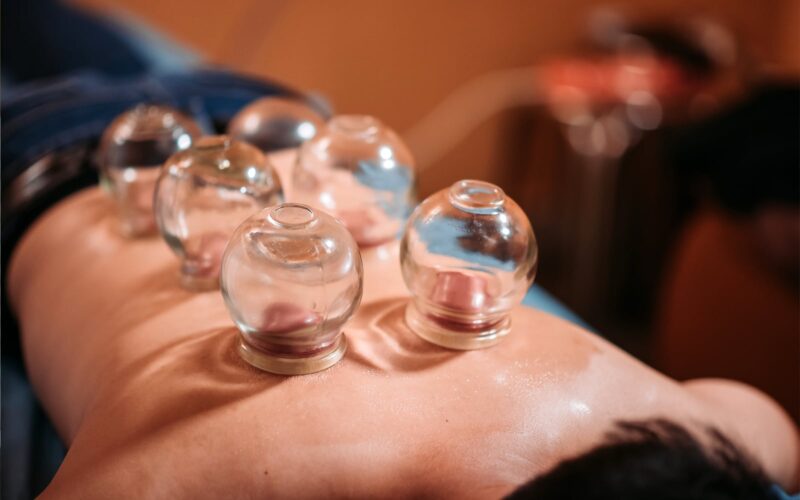 cupping therapy session showcasing glass cups placed on a patient’s back to stimulate healing and relaxation